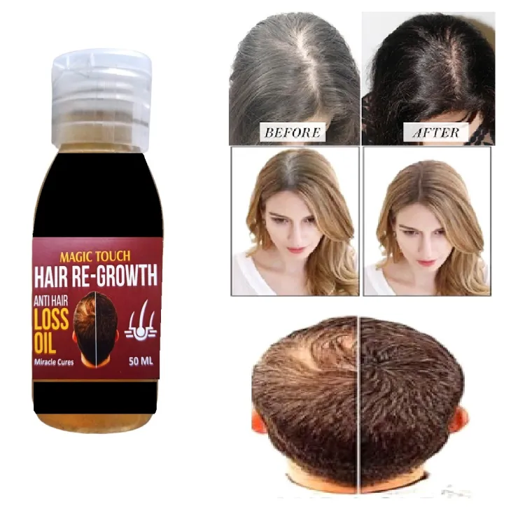 Magic Touch Hair Regrowth Anti Hair Loss Oil 50 ml