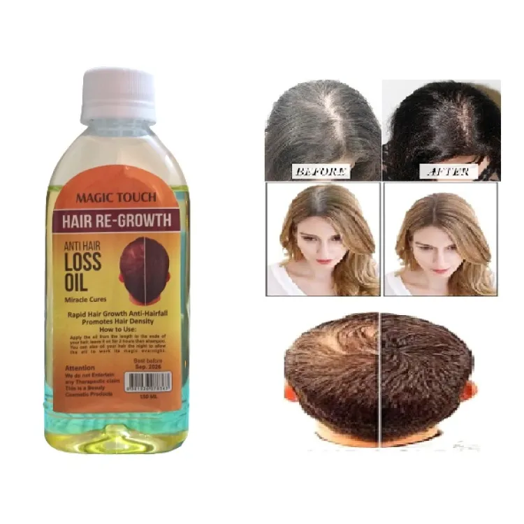 Magic Touch Regrowth Hair Oil 150 ml